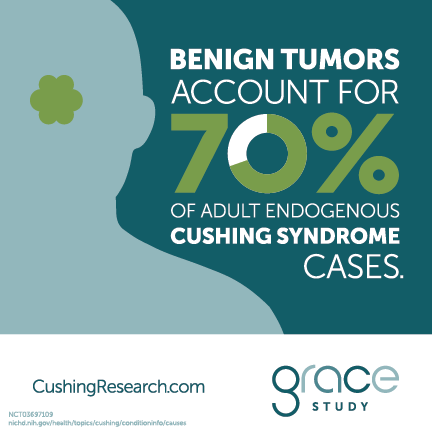 Benign tumors account for 70% of adult endogenous Cushing syndrome cases.